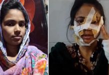 নড়াইলে ডিভোর্স দেয়ায় গৃহবধূ ওপর হামলা, শরীরে অর্ধশত সেলাই