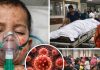 গত ২৪ ঘণ্টায় হামের উপসর্গ নিয়ে আরও তিনজনের মৃত্যু